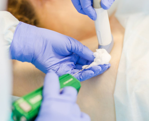 Биопсия молочной железы