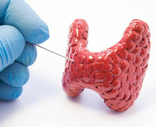 Биопсия щитовидной железы